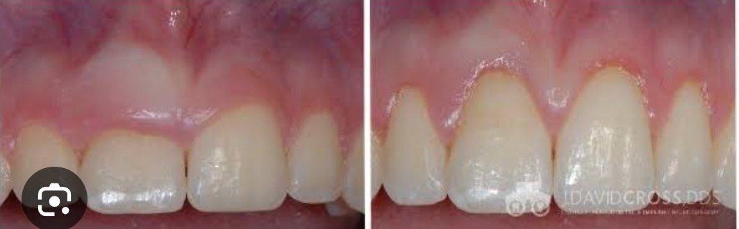 aku koas gigi yang mau dirawat boleh dm tweet media