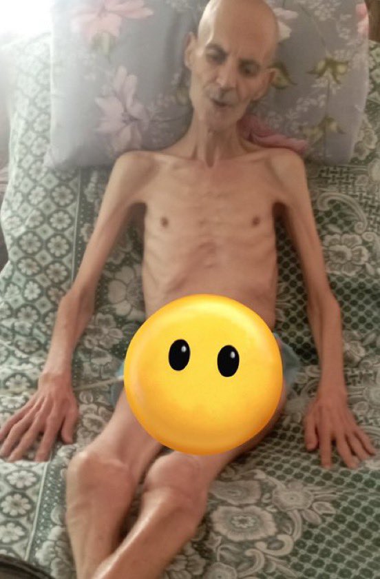 MyPalestine0's tweet image. تخيل ان تشاهد أباك يصل لهذه الحالة وأنت عاجز عن فعل شيء!!
تحدثوا عن المجاعة في قطاع غزة