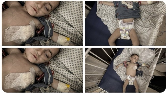 Gaza's children are suffering from famine.