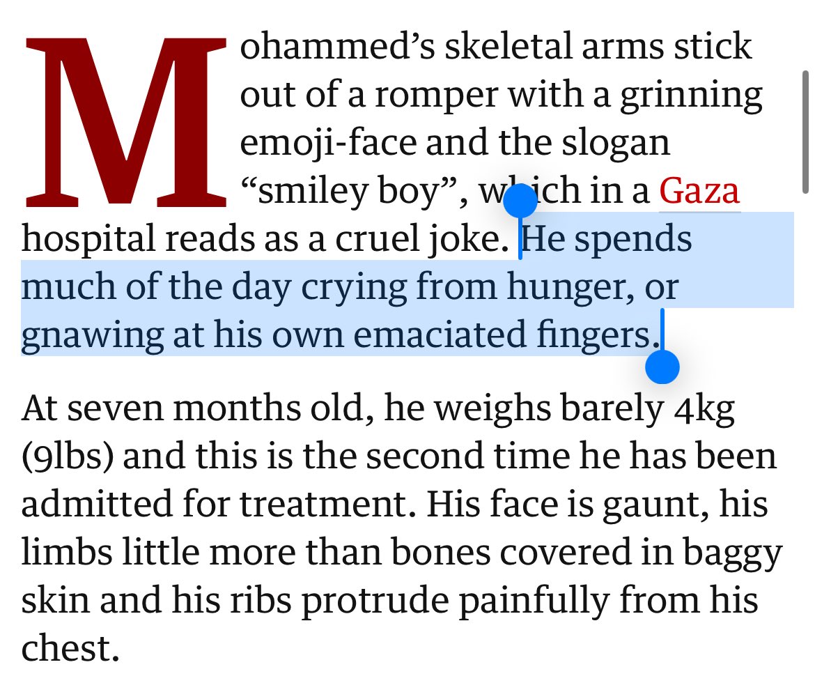 At 7 months, HE WEIGHTS LIKE A NEWBORN. Israel is starving children.
