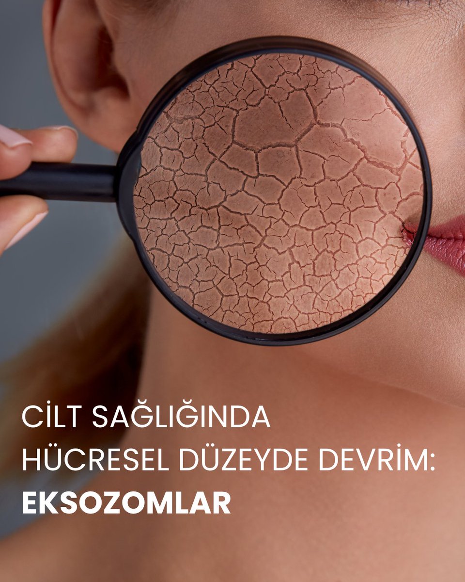 Eksozomlar: Cilt Sağlığında Hücresel Düzeyde Devrim

Eksozom Nedir? Cilde Nüfuz Mekanizması ve Etki Alanlarıve Cilt Bakımında Eksozomların Faydaları

Hemen Okuyun: instagram.com/p/DMfUfToxsSt/ 

#Eksozom #Exosome #CiltBakımı #CiltSağlığı #KökHücre #Stemcell #Dermoten #StemAgé