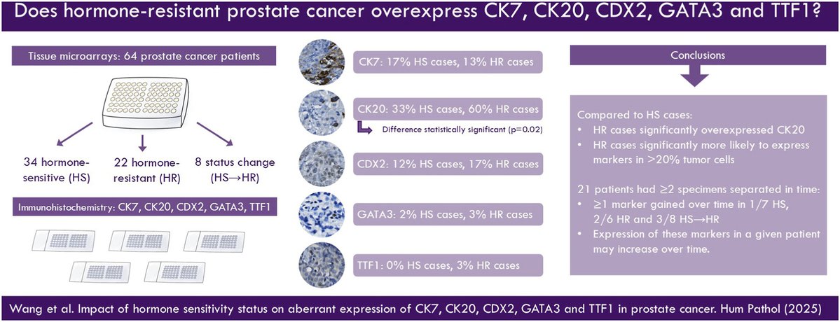 Human_Pathology's tweet image. New in #HumPathol: Impact of hormone sensitivity status on aberrant expression of CK7, CK20, CDX2, GATA3 and TTF1 in prostate cancer. sciencedirect.com/science/articl… #pathology #PathTwitter #PathX #GUpath
