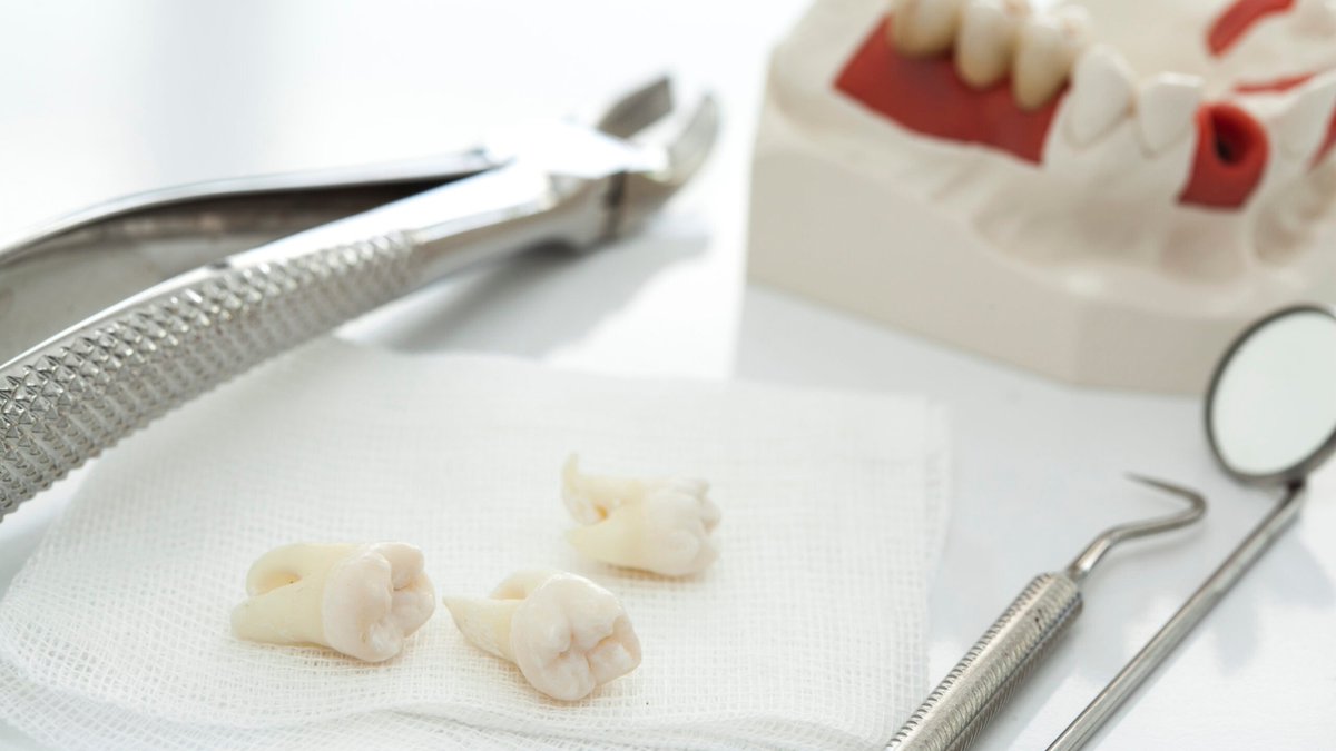 HealthNest1's tweet photo. Get gentle and effective care with our expert wisdom teeth surgery—quick recovery, less pain, and lasting relief. Book your appointment today!

https://t.co/2nvB7Xe3hO

#OralSurgery #WisdomTeethSurgery #DentalCare #ToothExtraction #BrooklynDentist #Newwavedentistry https://t.co/IXhNBZeKyA