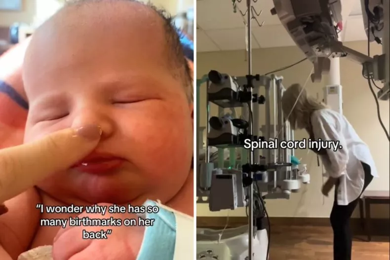 resilient333's tweet image. And another bitty baby suffers...'suddenly'😪💔
*Newborn-1 day old-USA
*July 20, 2025 (published)
*Mother Mackenzie Dodd summed up the whiplash of noticing something minor in 2022 about her newborn baby, only to discover a shocking diagnosis.
*"I wonder why she has so many…