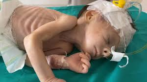 DanielLeahy11's tweet image. #UK #London #Manchester #Scotland #Wales
Your @UKLabour Government are MAKING YOU ALL ACTIVE PARTICIPANTS IN #Genocide
@DavidLammy is STILL PROVIDING WEAPONS TO ISRAEL, THE SAME WEAPONS BEING USED TO SLAUGHTER A STARVING POPULATION WAITING FOR AID, Men, Women & CHILDREN