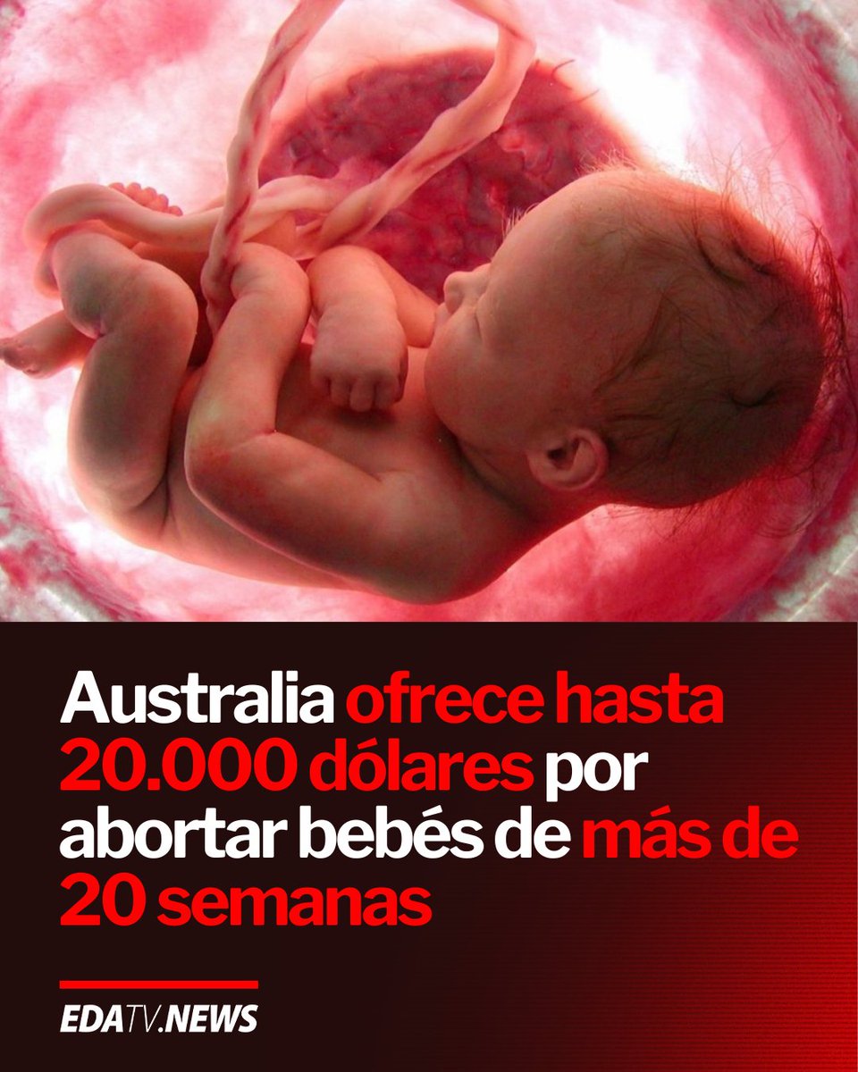 edatvoficial's tweet image. 🇦🇺 | Australia ofrece hasta 20.000 dólares por abortar bebés de más de 20 semanas. El 80% de abortos son de fetos sanos un acto deliberado de matar.