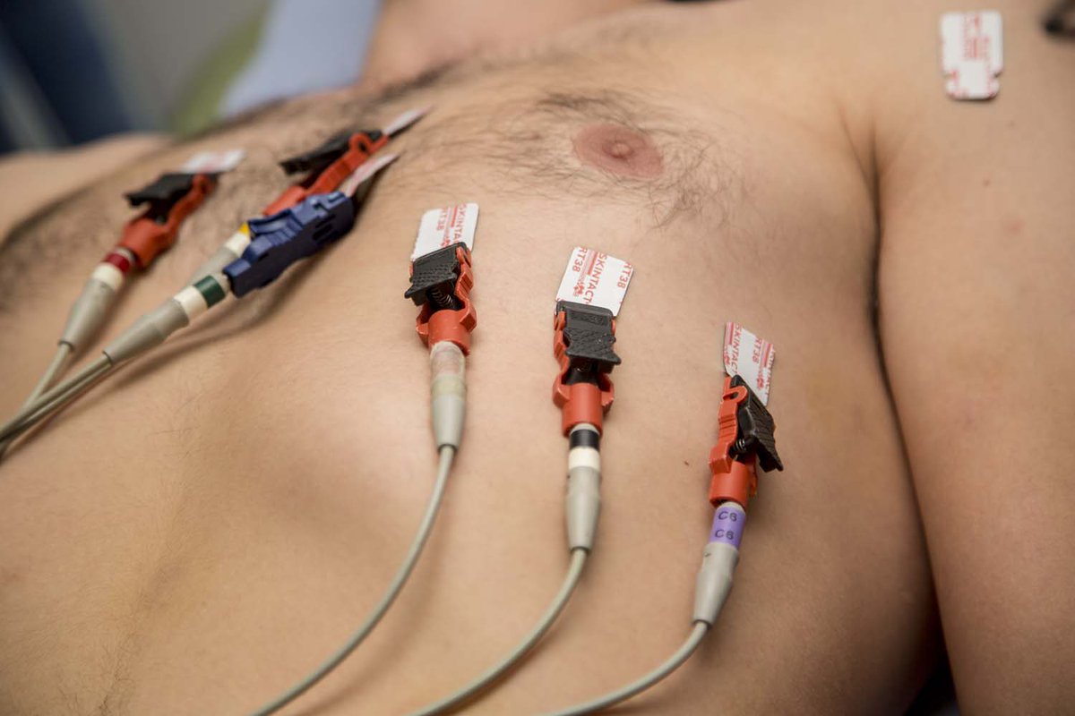 CRY_UK's tweet image. 12 young people lose their lives to undiagnosed heart conditions every week.
Are you between 14-35? Join CRY’s free cardiac screening program and get peace of mind. Early detection can save lives! 🩺 #TestMyHeart
👉 Register now at testmyheart.org.uk