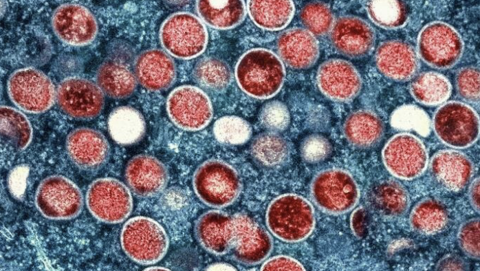 Gambia identified its first case of mpox reported in the country amid West African surge.
spr.ly/6019fKG2Z