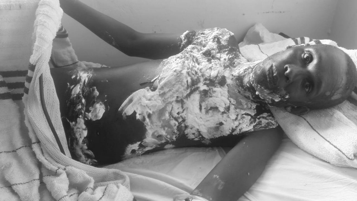 TORTURED FOR BEING POOR: PATRICK KINYANJUI'S HORROR AT THIKA LEVEL 5 HOSPITAL🛑

 This is not just a case of medical negligence. This is a story of inhumanity, class brutality and the systemic violence the poor endure in silence.

Patrick Kinyanjui, a 35 yo father from Kiandutu