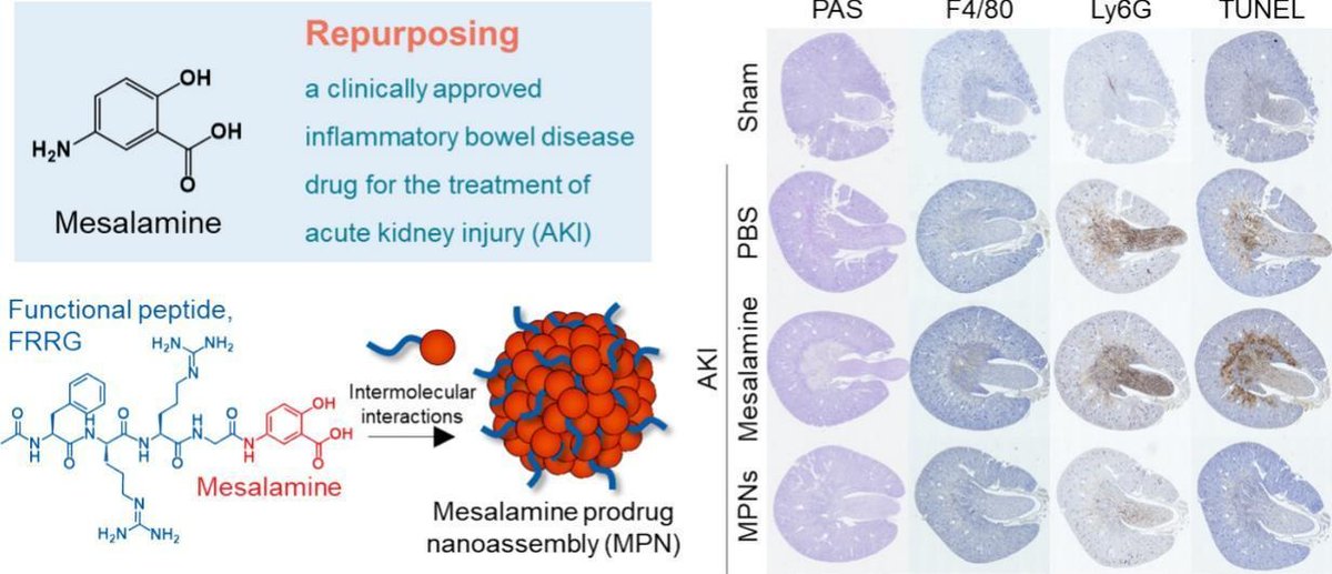 JCRnEDITORS's tweet image. Repurposing mesalamine for acute kidney injury through supramolecular assembly.
| Man Kyu Shim @KistPublic | @KoreaCRS 
[Open Access]
#prodrug #supramolecule #nanoassembly #KidneyInjury
kwnsfk27.r.eu-west-1.awstrack.me/L0/https:%2F%2…