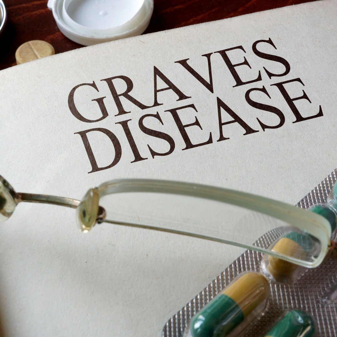 thyroiduk_org's tweet image. 💜 It’s Graves’ Awareness Month!
Graves’ disease is the most common cause of hyperthyroidism—an autoimmune condition where the thyroid becomes overactive due to immune attack.
More info 👉 thyroiduk.org/if-you-are-hyp…
#GravesDisease #ThyroidAwareness