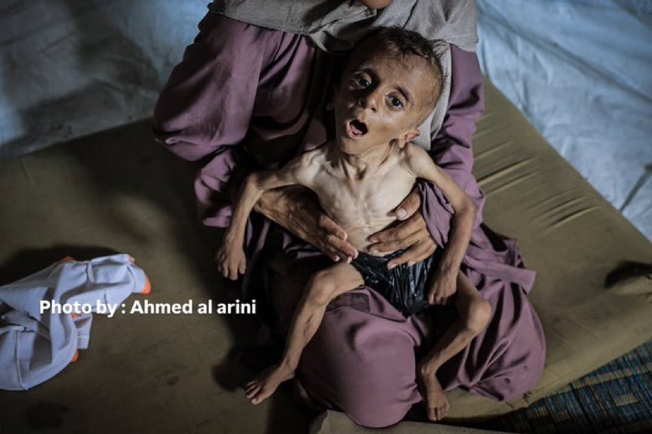 If you’re scrolling, PLEASE leave a dot.

Gaza is starving.