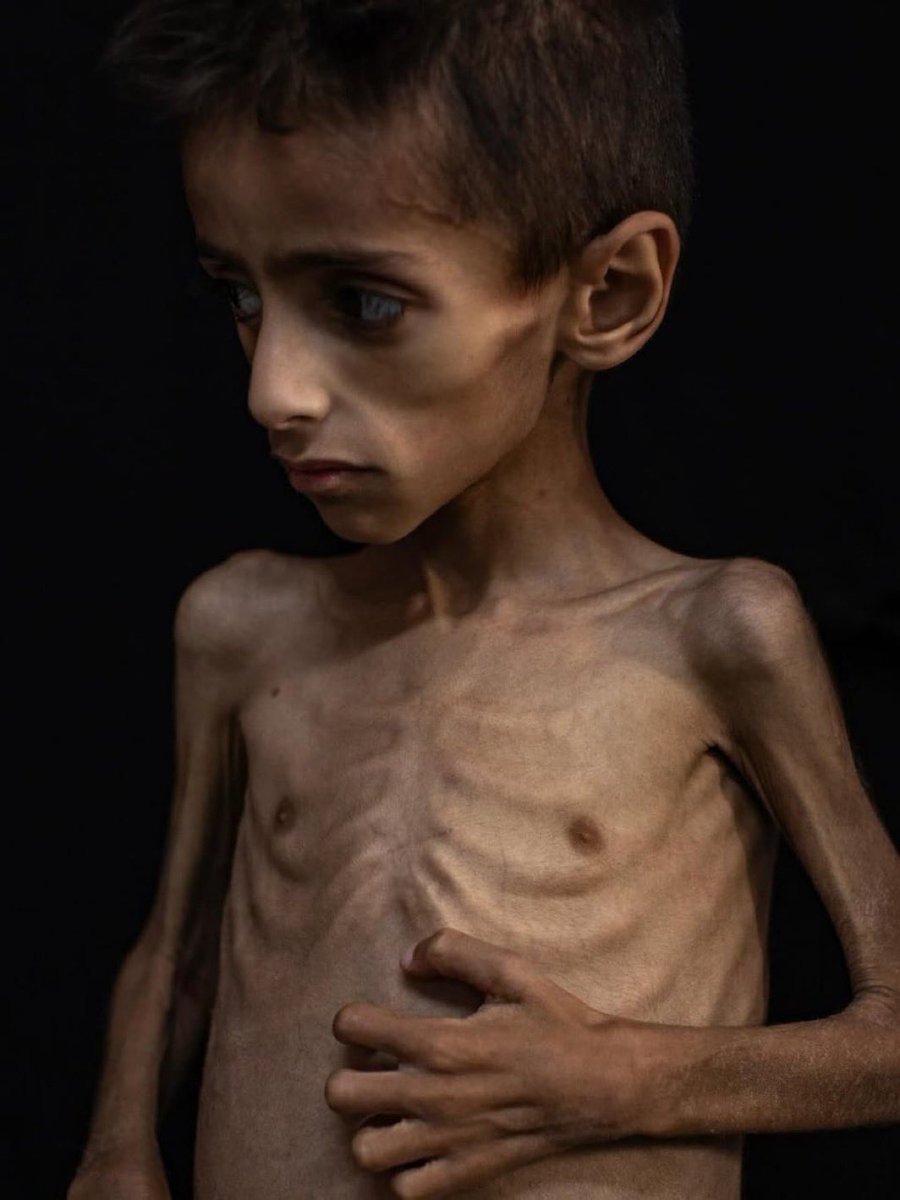 If you see this pic, reply with 🇵🇸 spread it 💔

We are starving.