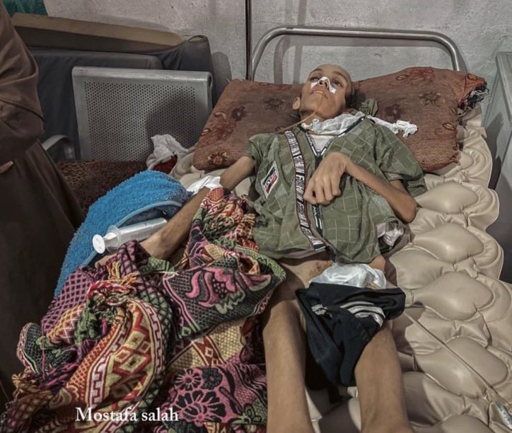 Gaza is starving. 

Are you still with us ? Do you hear us !
Reply with 🇵🇸 if you see this pic, pass it ... 💔