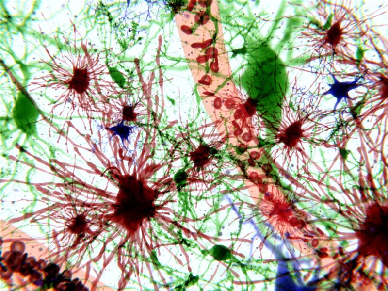 URNeuroscience's tweet image. A Review via @ToxSci: From pesticides to heavy metals, diverse environmental toxins can trigger astrocytic senescence—shedding light on how pollution may accelerate neurodegenerative disease #URochesterResearch @UR_IHHE @URochester_SMD
Paper: doi.org/10.1093/toxsci…