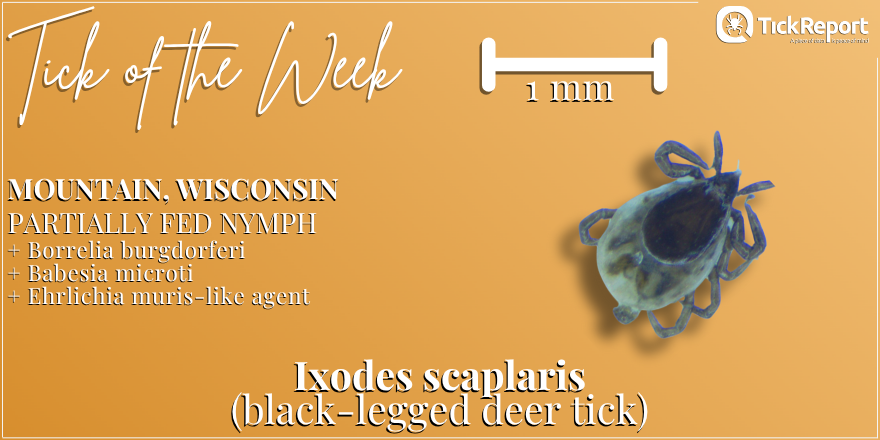 This black-legged deer tick from Oconto County, Wisconsin, was carrying three pathogens: Borrelia burgdorferi (Lyme disease), Babesia microti (babesiosis), and Ehrlichia muris-like agent (ehrlichiosis)!