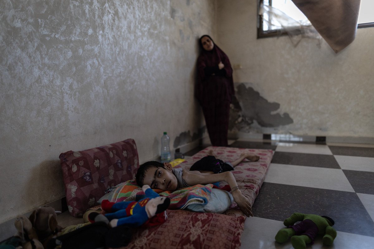 HananBalkhy's tweet image. #Gaza is starving, putting people at risk, alongside bombs and bullets.
Severe acute malnutrition centres are full, with only limited supplies remaining for treatment.
@WHO has documented 21 deaths related to malnutrition of children under five-years-old in 2025. Over 20 percent…