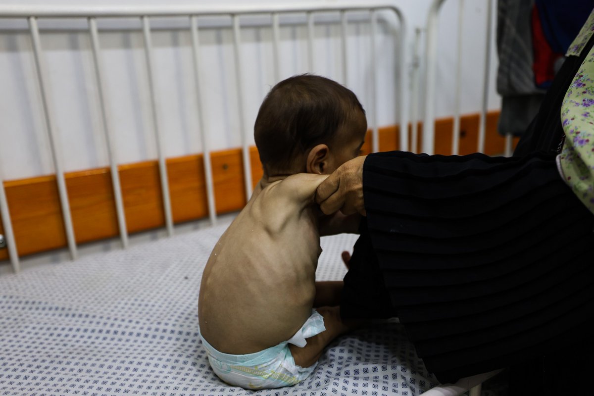HananBalkhy's tweet image. #Gaza is starving, putting people at risk, alongside bombs and bullets.
Severe acute malnutrition centres are full, with only limited supplies remaining for treatment.
@WHO has documented 21 deaths related to malnutrition of children under five-years-old in 2025. Over 20 percent…