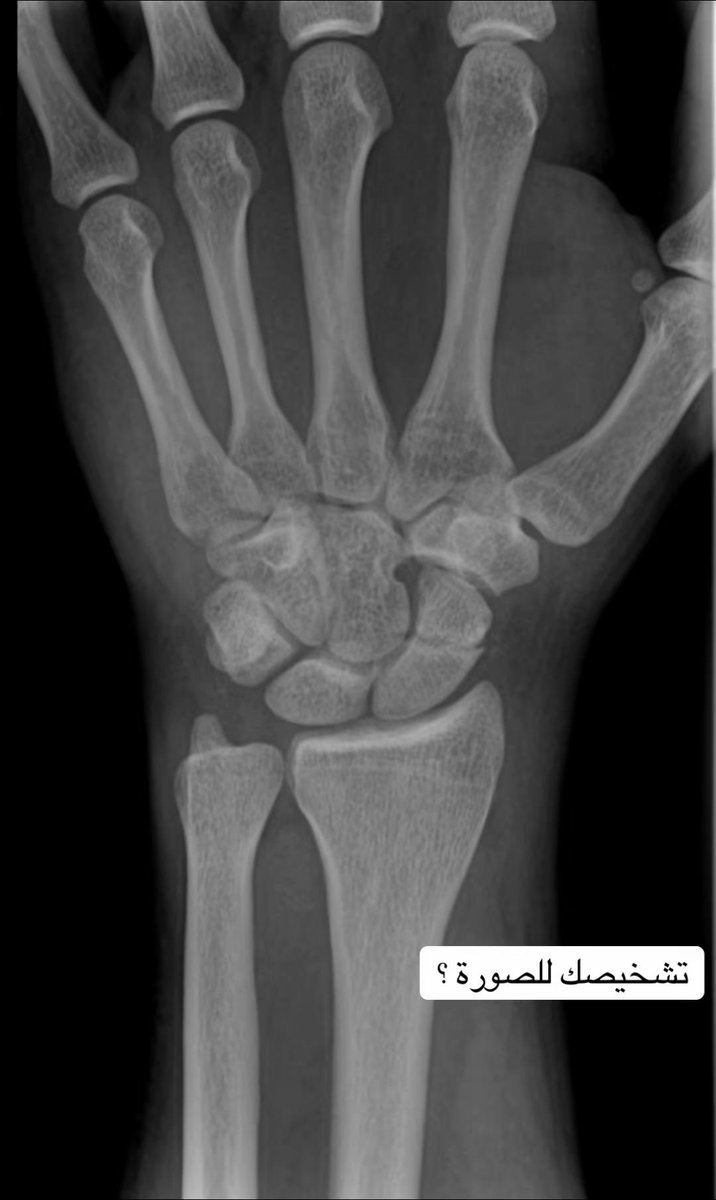 بَتّال صابر | علاج طبيعي tweet media