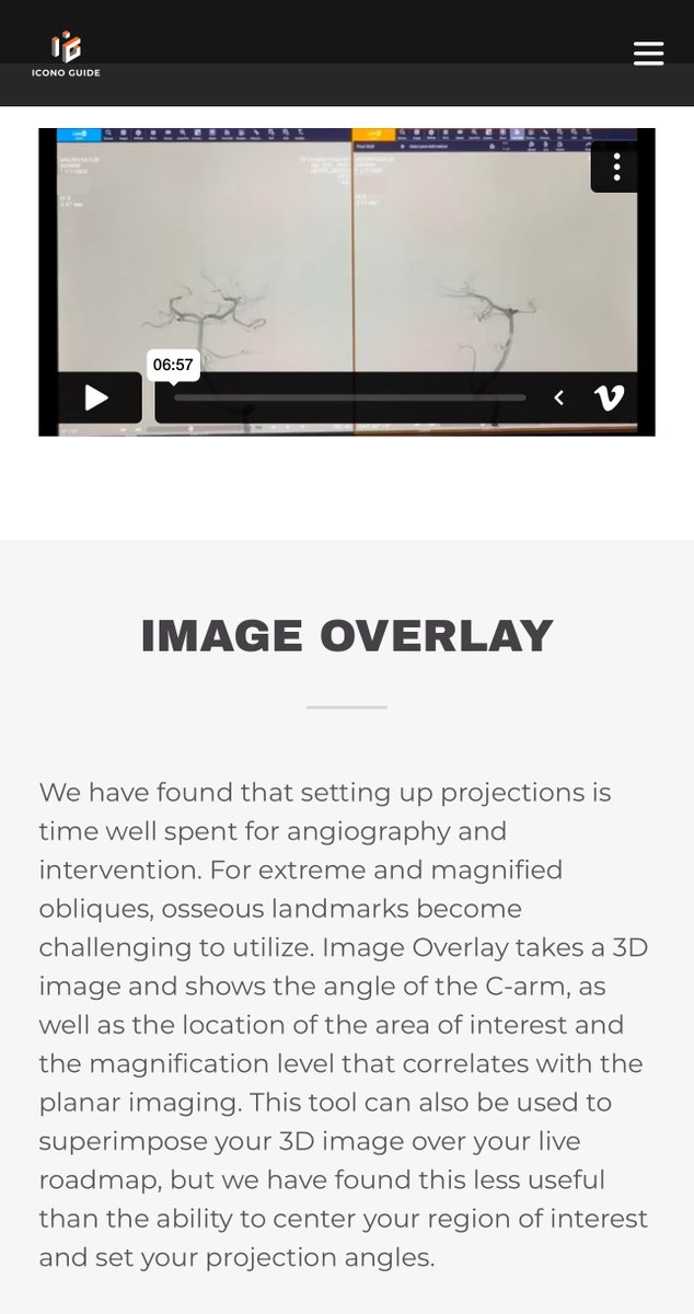 IconoGuide's tweet image. New content added: 3D-3D Fusion and Image Overlay. Check it out under “Technique Details” at Iconoguide.com