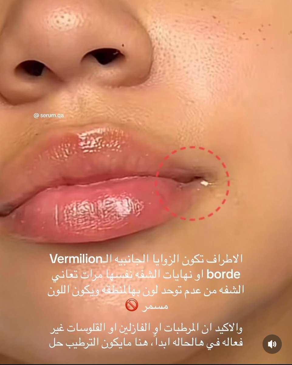 48Nasreen's tweet image. التصبغات اللي تجي حول الشفايف مزعجه وماتروح بسرعه بس سيروم العين هذا رهيييب ومفعوله قوي وسريع