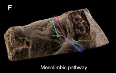 k_scheitler's tweet image. Our latest work, “Application of a Human Stereotactic System for Image-Guided Deep Brain Stimulation Neurosurgery in a Swine Model,” is now published in @brainstimj. Grateful to the team, mentors, and SNS NSTP grant support behind this @MayoClinicNeuro @Kendall_Lee1 @Brainlab…