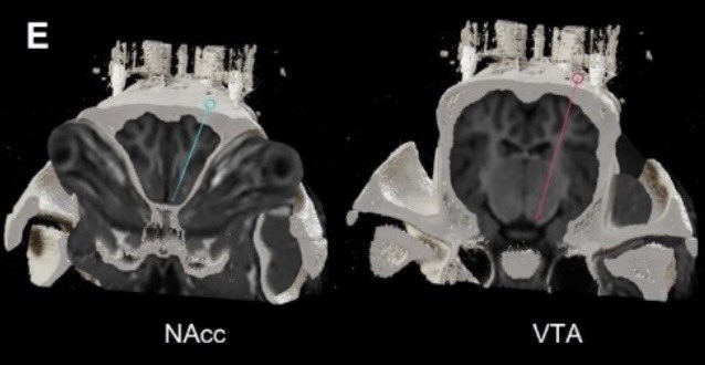 k_scheitler's tweet image. Our latest work, “Application of a Human Stereotactic System for Image-Guided Deep Brain Stimulation Neurosurgery in a Swine Model,” is now published in @brainstimj. Grateful to the team, mentors, and SNS NSTP grant support behind this @MayoClinicNeuro @Kendall_Lee1 @Brainlab…