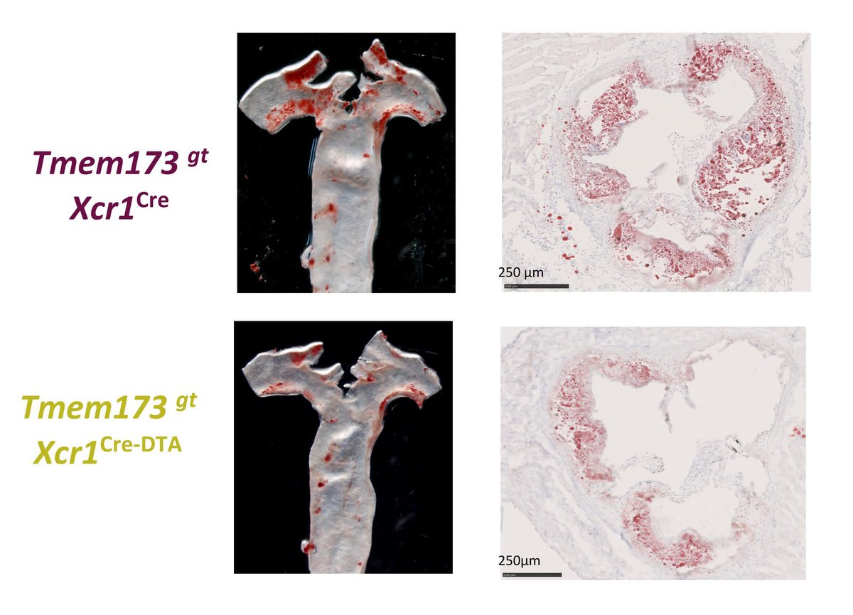 Circulation Research (@circres) on Twitter photo Galán et al found that #cDC1s are proatherogenic via local #immunity & developed a novel #immunotherapy for #atherosclerosis based on cDC1-targeted lipid #nanoparticles. Learn more at ahajrnls.org/3GVqEZy
@Sancholab @SBiomagMfb <a href="/aramiro_ramiro/">Almudena Ramiro</a> <a href="/CarregalSusana/">Susana Carregal</a> Galán et al found that #cDC1s are proatherogenic via local #immunity & developed a novel #immunotherapy for #atherosclerosis based on cDC1-targeted lipid #nanoparticles. Learn more at ahajrnls.org/3GVqEZy
@Sancholab @SBiomagMfb <a href="/aramiro_ramiro/">Almudena Ramiro</a> <a href="/CarregalSusana/">Susana Carregal</a>