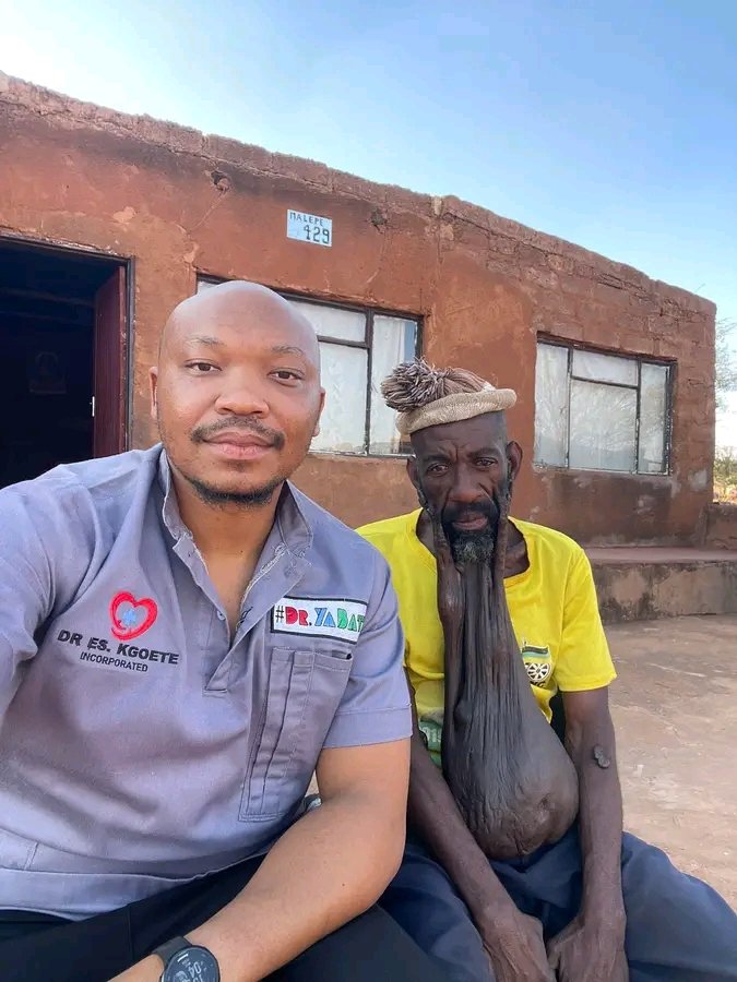 DiphiriBen10's tweet image. Limpopo Government Concerned About Keloid Patient Refusing Treatment
The @OtpLimpopo is aware of and concerned about a patient from Fetakgomo/Tubatse in Sekhukhune who has been suffering from a keloid for an extended period.