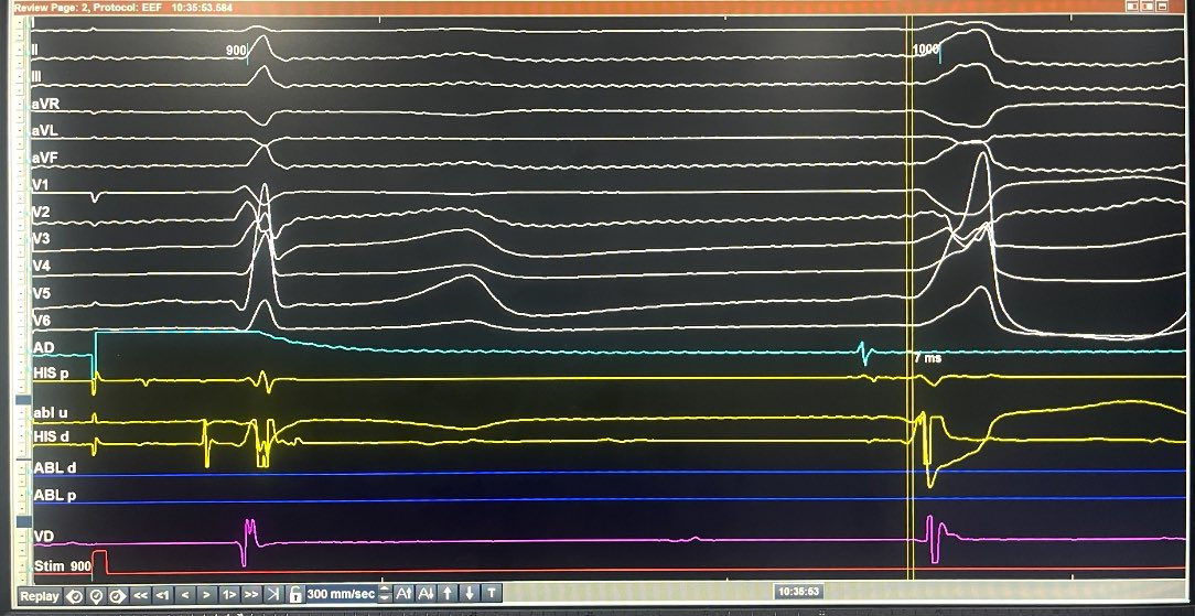 ALBERTO ALFIE tweet media
