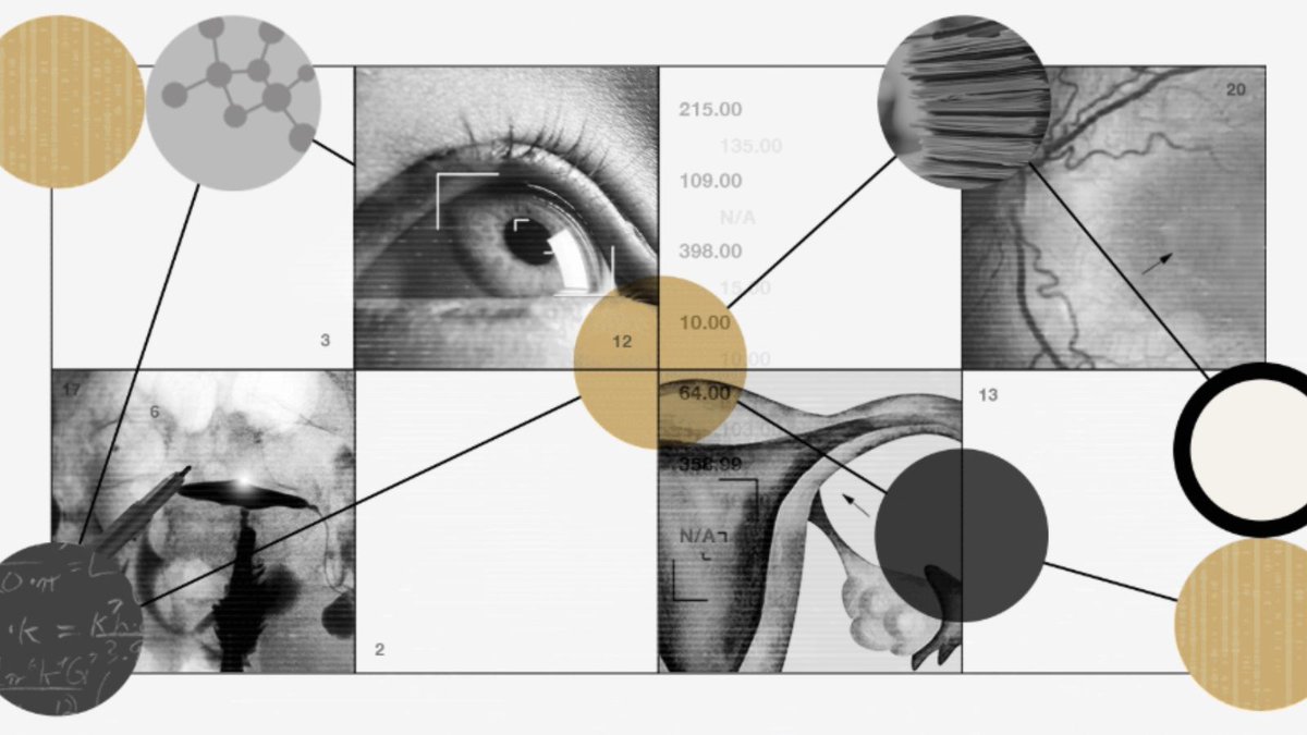 CCTSI's tweet image. @CCTSI's Director of Health Informatics, @kalpathy1, helped develop a low-cost AI tool that analyzes cervical images and HPV data to improve early cancer detection. Tested in 50,000 women, it helps ID those at highest and lowest risk. buff.ly/G7mJdof