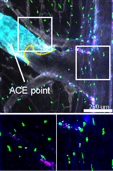 tmamuladze's tweet photo. This mechanism serves as a frontline defense against CNS infection. Pathogens such as S. agalactiae and S. pneumoniae exploit ACE points to access the brain. Mast cell activation redirects CSF flow and recruits neutrophils, limiting this bacterial invasion. https://t.co/3y8lIX1X6P