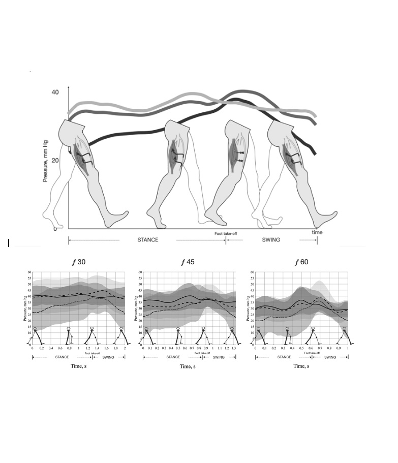 JVSVL's tweet image. A great day starts with curiosity! Explore how thigh muscle pump affects venous outflow in our new JVSVL article! #veins #muscle_pump #VenousEd #JVSVL#vascularsurgery
jvsvenous.org/article/S2213-…
