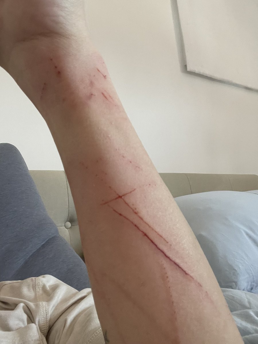 kwansfull's tweet image. Cat had something stuck in her mouth, tried to get it out myself and got this instead, at the vet now 🐱