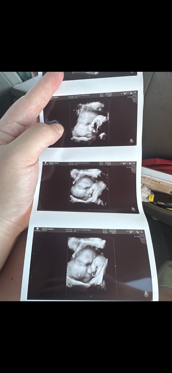mgoffdagas's tweet photo. About a month away.. shits gettin real 😅

Juni’s little brother Alonzo (Zo) ❤️ https://t.co/7Gdn7g4j11