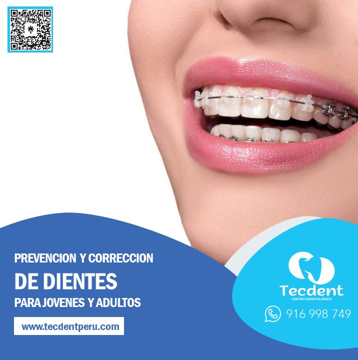 Tecdentperu's tweet photo. 💙A pesar de lo que se piensa comúnmente, los tratamientos de ortodoncia no sólo pretenden mejorar la estética de nuestra boca, sino que favorecen la propia funcionalidad de los dientes.

#tecdentperu #creandotusonrisaideal https://t.co/4U9EQzjbp8