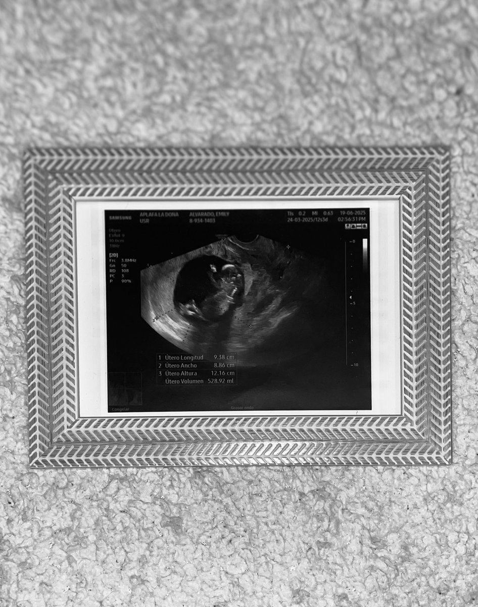 milly22m's tweet photo. Una mamita guapa y enamorada🤰🏽✨🤍 https://t.co/rqWgMLFnaM