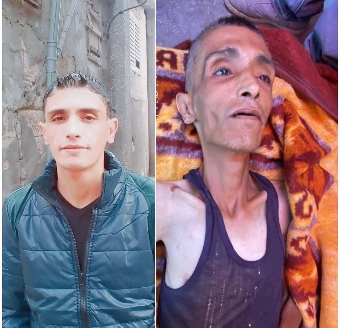 Gazzeli açlıktan ölüyor..!!