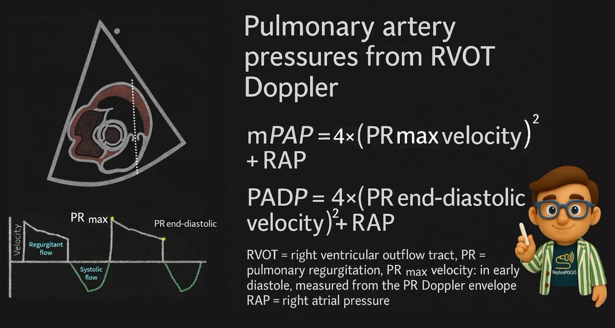 NephroP's tweet image. mPAP and PDAP from RVOT Doppler
#POCUS #FOAMed #FOAMcc