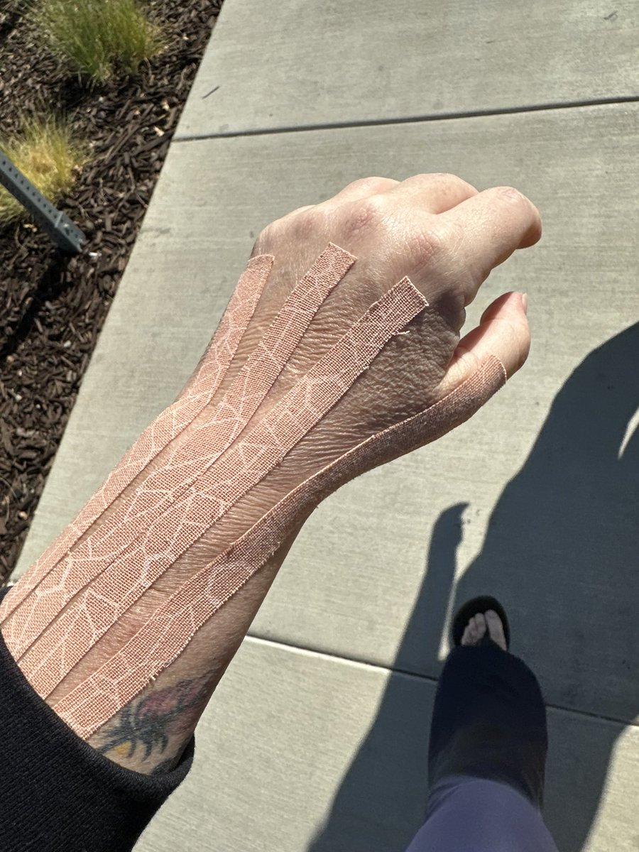 When you have crazy soft skin due to a condition, and they put KT Tape on 😜 I look like a wrinkled giraffe!!🤣🤣🤣this should be interesting