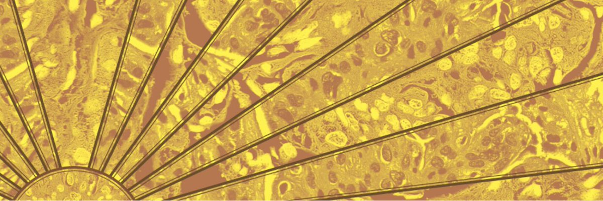 CUIMCDeptofMed's tweet image. Join us for a special CME event! C3G &amp;amp; Immune Complex MPGN Updates: Where We Are &amp;amp; Where We Are Headed will be held virtually on October 03, 2025 from 8:25 AM - 1:30 PM (ET). Columbia University Medical Center invites you to join the leading educators from Columbia University,…