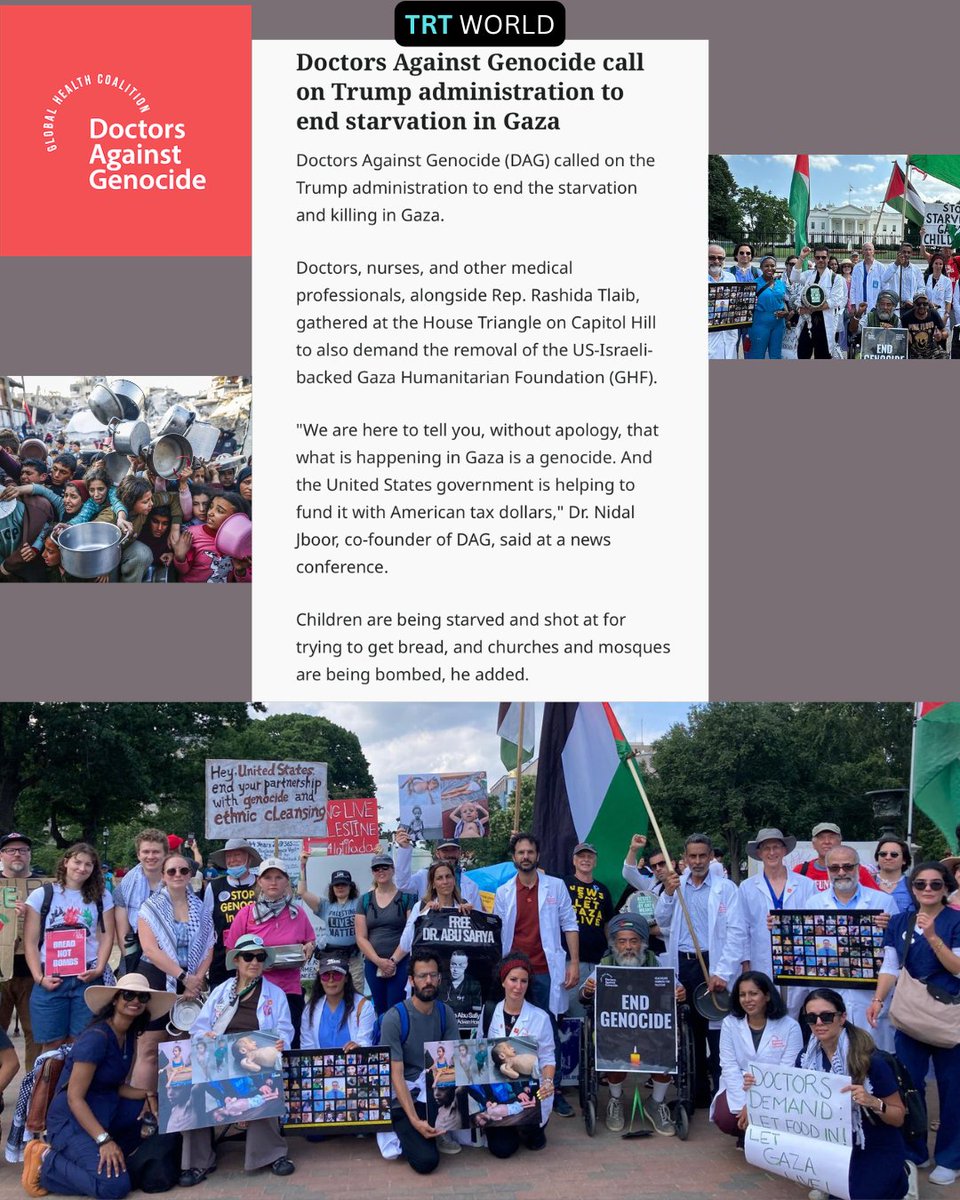 Doctors report horrifying symptoms unseen in modern times—hair loss, fluid retention, and organ failure. A whole generation now faces lifelong cognitive and physical impairments due to starvation during critical brain development years.

One doctor said: “Israel has used the