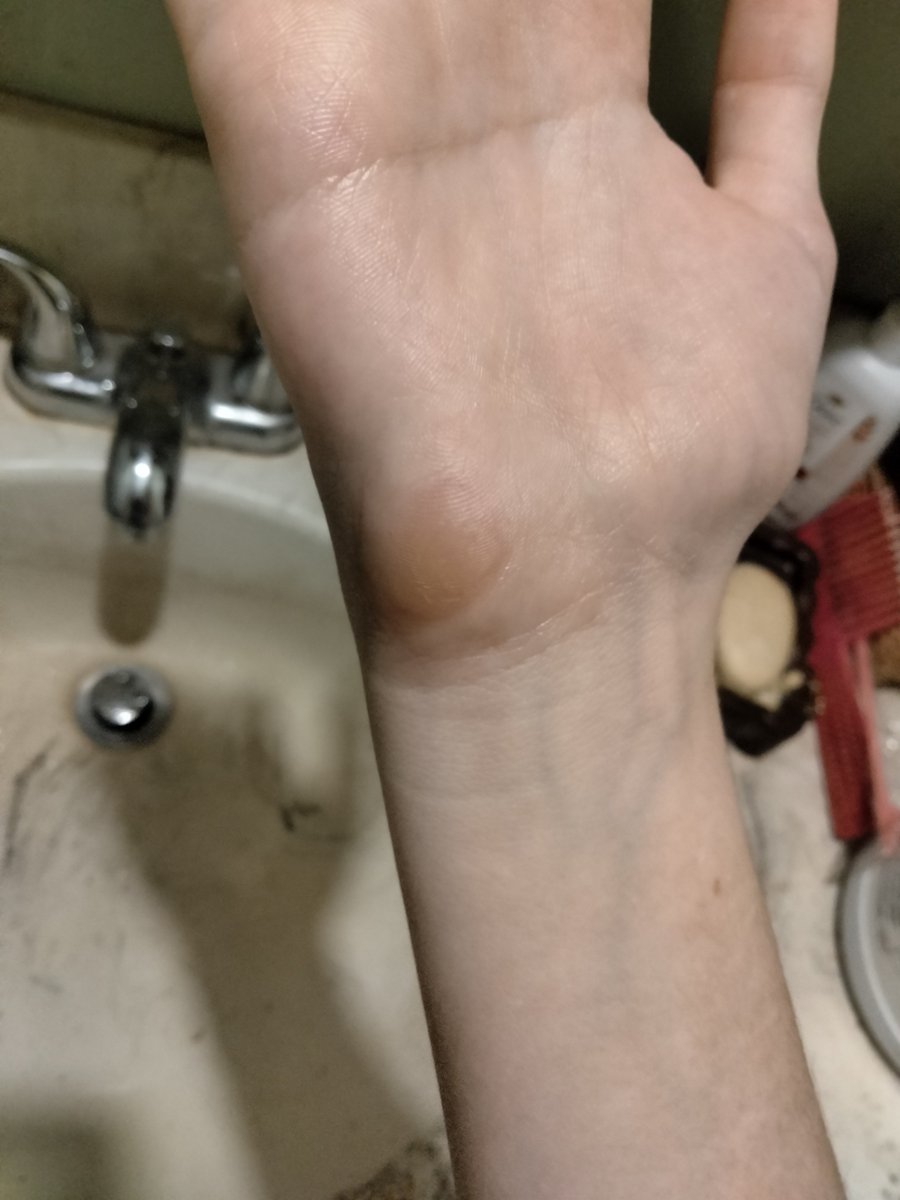 gyllenfreak's tweet image. I have a single brown callous on one hand from leaning too hard against it lol