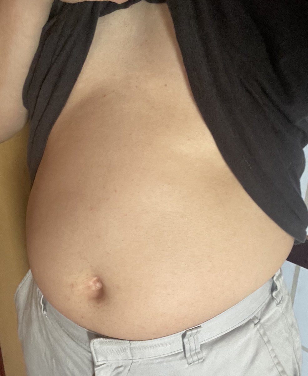 太膨狐🦊 tweet media