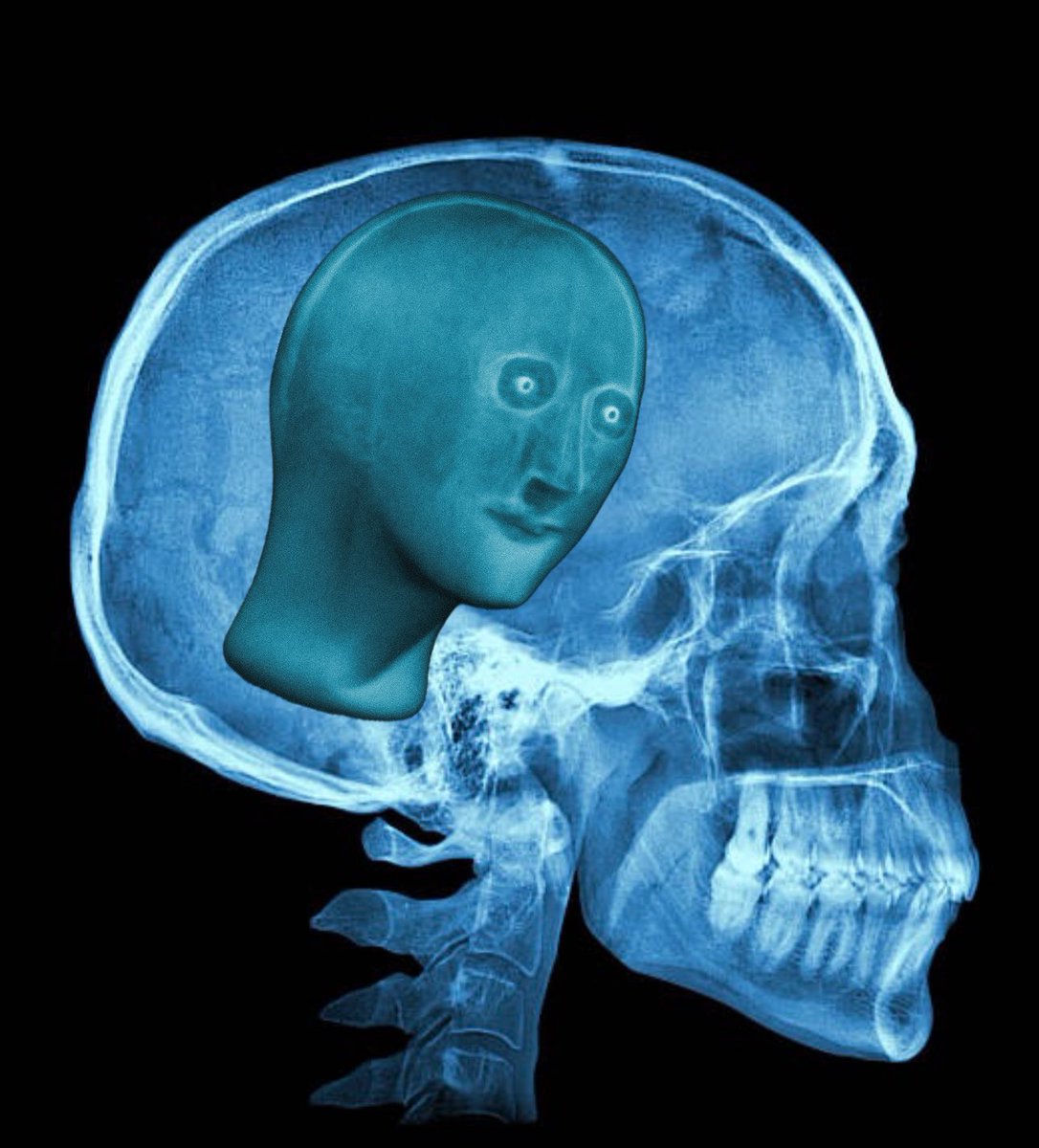 ankedo00's tweet image. What’s on your mind?