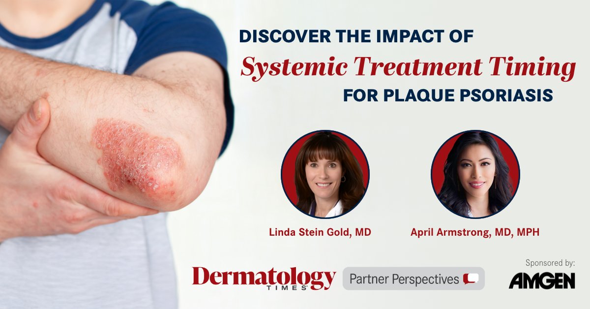 Discover the impact of initiation timing of a systemic treatment option for plaque psoriasis. Learn more: hubs.li/Q03yB-2F0