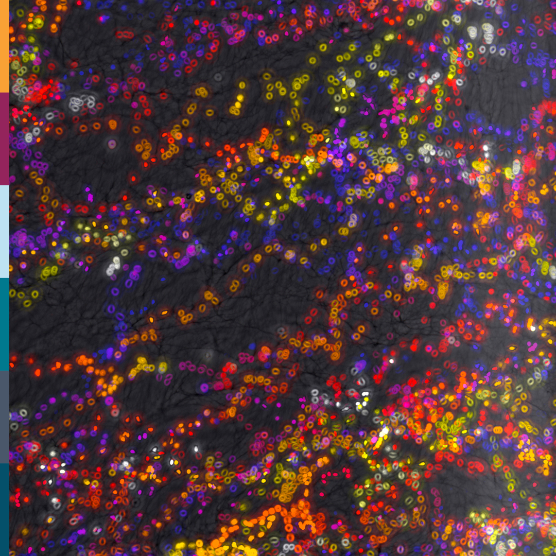 WEHI_research's tweet image. Immune cells are constantly on the move, defending us from infections. Time-lapse imaging reveals their intricate activity, helping researchers unlock new therapies.
Learn more about our work at the Snow Centre for Immune Health: snowimmunehealth.org.au
@SnowMedical