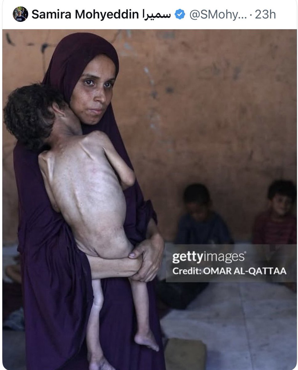 Mass starvation is unconscionable. Humanitarian aid now. Ceasefire now.