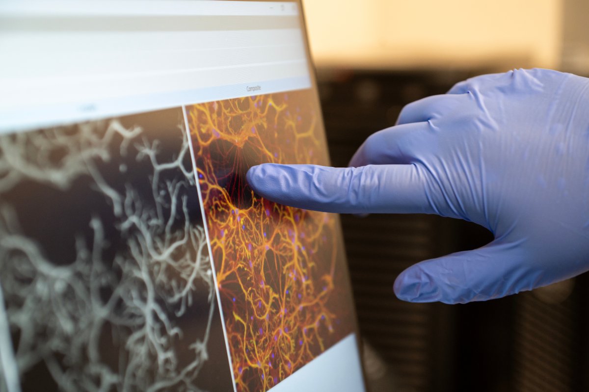 GladstoneInst's tweet image. From discovering therapies that can repair the brain after stroke to using machine learning to detect early signs of cognitive decline, our researchers are at the forefront of neurological research. 

Discover some of Gladstone’s latest breakthroughs:  bit.ly/4lGQnUD