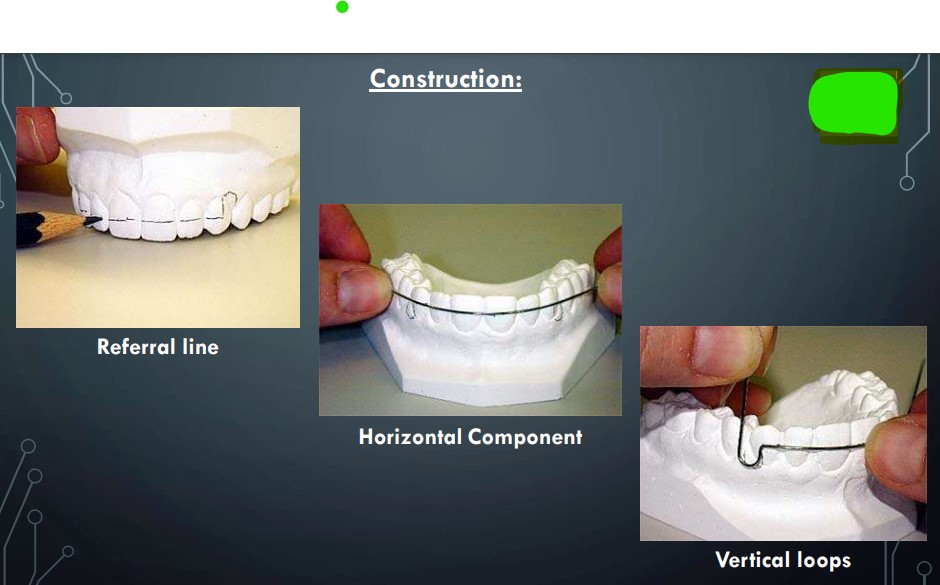 short labial bow Construction